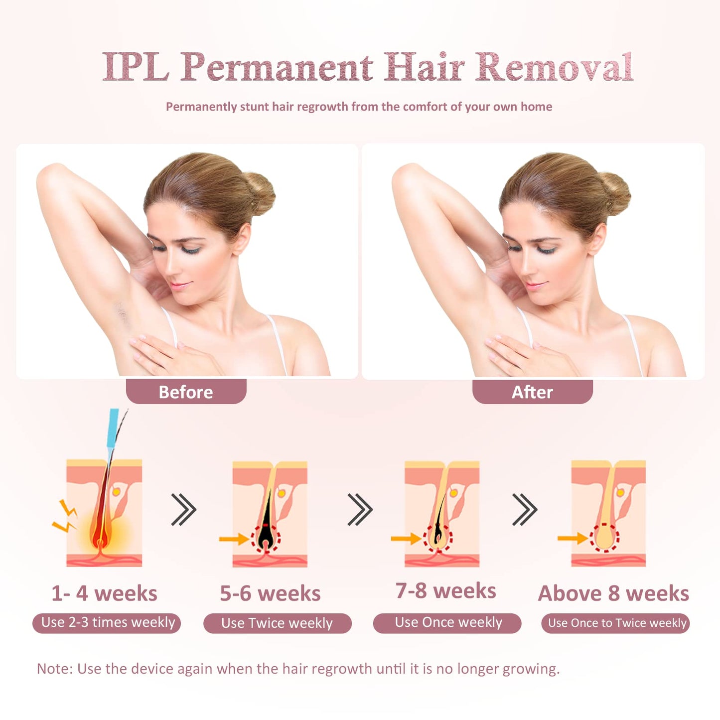 REDFMG Laser Hair Removal for Women at Home, for Facial Armpits Legs Bikini Line Whole Body